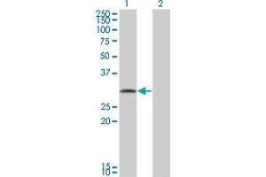 Western Blot analysis of FGFR1OP2 expression in transfected 293T cell line by FGFR1OP2 monoclonal antibody (M01), clone 2G4. (FGFR1OP2 antibody  (AA 62-169))