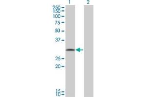 Western Blot analysis of FGFR1OP2 expression in transfected 293T cell line by FGFR1OP2 monoclonal antibody (M01), clone 2G4. (FGFR1OP2 antibody  (AA 62-169))