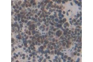 IHC-P analysis of Mouse Tissue, with DAB staining. (LMYC antibody  (AA 186-439))