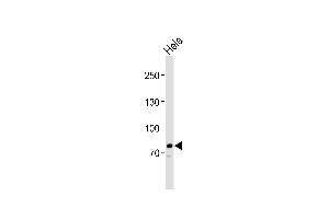 Western blot analysis of lysate from Hela cell line, using PCSK9 Antibody at 1:1000. (PCSK9 antibody  (C-Term))