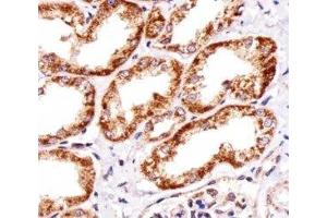 Immunohistochemical analysis of paraffin-embedded human kidney section using INSRR antibody; Ab was diluted at 1:25 dilution. (INSRR antibody  (AA 668-702))