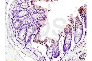 Formalin-fixed and paraffin embedded mouse kidney tissue labeled with Anti-TNFSF18 Polyclonal Antibody, Unconjugated (ABIN740535) at 1:200 followed by conjugation to the secondary antibody and DAB staining