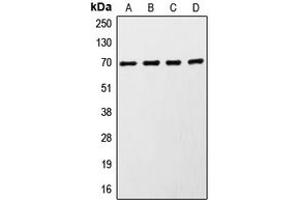 Western blot analysis of S6K1 expression in MCF7 (A), HeLa (B), HEK293 (C), mouse brain (D) whole cell lysates.