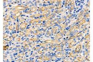 ABIN6260054 and ABIN6272249 at 1/100 staining Mouse kidney tissue by IHC-P. (ARRDC1 antibody  (C-Term))