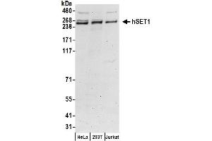 anti-hSET1 (C-Term) antibody