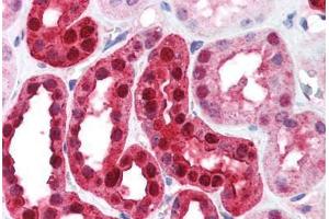 Human Kidney (formalin-fixed, paraffin-embedded) stained with CA2 antibody ABIN214579 at 5 ug/ml followed by biotinylated goat anti-rabbit IgG secondary antibody ABIN481713, alkaline phosphatase-streptavidin and chromogen. (CA2 antibody)
