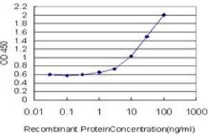 Detection limit for recombinant GST tagged GALT is approximately 0. (GALT antibody  (AA 1-379))