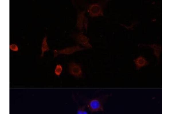 WDR81 antibody