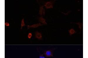 Immunofluorescence analysis of PC12 cells using WDR81 Polyclonal Antibody at dilution of 1:100. (WDR81 antibody)