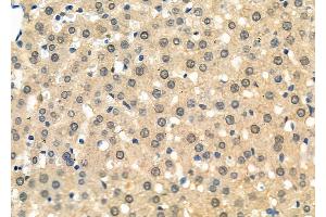 ABIN6264613 and ABIN6277733 at 1/100 staining Rat liver tissue by IHC-P. (RAD21 antibody  (C-Term))