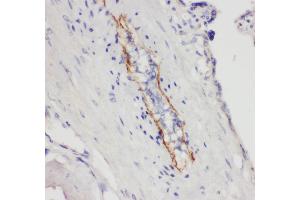 Anti- CD62P antibody, IHC(P) IHC(P): Human Placenta Tissue (P-Selectin antibody  (N-Term))