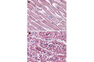 Immunohistochemical (Formalin/PFA-fixed paraffin-embedded sections) staining in human heart (A) and human adrenal gland (B) with SSTR5 polyclonal antibody . (SSTR5 antibody  (2nd Extracellular Domain))