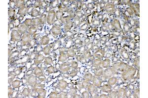 IHC analysis of GST3 / GST pi using anti-GST3 / GST pi antibody . (GSTP1 antibody  (AA 2-210))