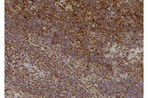 ABIN6276416 at 1/100 staining Mouse spleen tissue by IHC-P. (TRAF2 antibody  (C-Term))