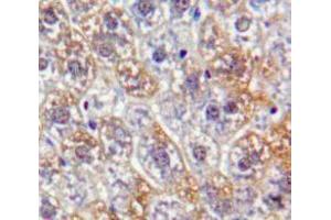 Used in DAB staining on fromalin fixed paraffin-embedded Liver tissue (PKN2 antibody  (AA 282-487))