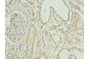 Immunohistochemistry of paraffin-embedded human kidney tissue using ABIN7158525 at dilution of 1:100 (ACSBG1 antibody  (AA 351-600))