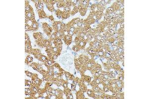 Immunohistochemistry of paraffin-embedded rat liver using MK1 antibody (ABIN7268647) at dilution of 1:100 (40x lens). (MAP3K1 antibody  (C-Term))