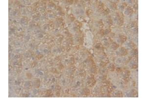 IHC-P analysis of Mouse Liver Tissue, with DAB staining. (GSTM1 antibody  (AA 1-218))