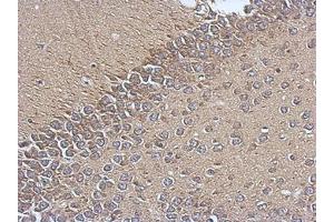 Image no. 1 for anti-Translocase of Inner Mitochondrial Membrane 17 Homolog A (TIMM17A) (AA 1-171) antibody (ABIN1501391) (TIMM17A antibody  (AA 1-171))