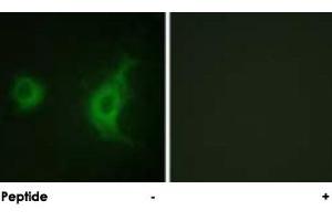 Immunofluorescence analysis of HUVEC cells, using KIF20A polyclonal antibody . (KIF20A antibody)