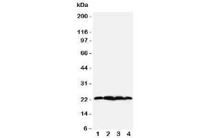 Western blot testing of BAG2 antibody (BAG2 antibody  (N-Term))