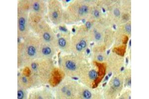 Used in DAB staining on fromalin fixed paraffin-embedded Liver tissue (FURIN antibody  (AA 105-221))