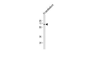 Anti-UGT2B4 Antibody (Center)at 1:2000 dilution + human cerebellum lysates Lysates/proteins at 20 μg per lane. (UGT2B4 antibody  (AA 338-370))