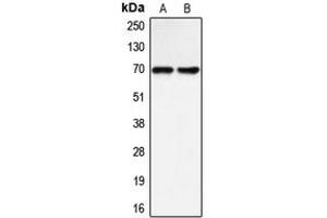 Western blot analysis of BLNK expression in Raji (A), LOVO (B) whole cell lysates.