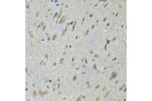 Immunohistochemistry of paraffin-embedded rat spinal cord using HDAC4 Antibody (ABIN5975864) at dilution of 1/100 (40x lens). (HDAC4 antibody)