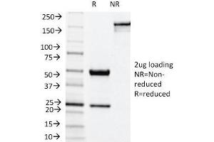 SDS-PAGE Analysis Purified NOX4 Mouse Monoclonal Antibody (NOX4/1245).