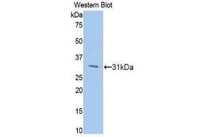 Western blot analysis of the recombinant protein. (PIK3CB antibody  (AA 807-1070))