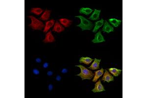 ABIN6261453 and ABIN6269282 staining HepG2 cells by IF/ICC. (EFNB1/2 (C-Term) antibody)