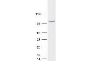 CCDC170 Protein (Myc-DYKDDDDK Tag)