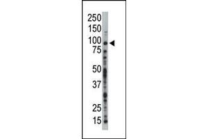 Image no. 1 for anti-Tousled-Like Kinase 1 (TLK1) (C-Term) antibody (ABIN360576) (TLK1 antibody  (C-Term))