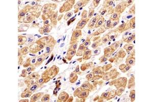 Immunohistochemistry (IHC) image for anti-Keratin 18 (KRT18) (AA 401-430) antibody (ABIN3031537)