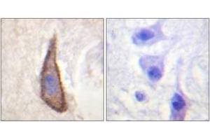 Immunohistochemistry analysis of paraffin-embedded human brain, using CD226/DNAM-1 (Phospho-Ser329) Antibody. (CD226 antibody  (pSer329))
