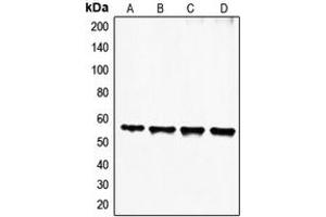 Western blot analysis of FGL2 expression in HeLa (A), Jurkat (B), HuT78 (C), Molt4 (D) whole cell lysates.