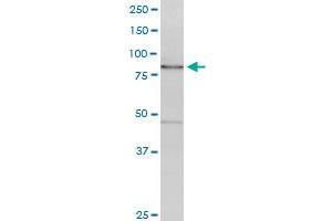 CAGE1 monoclonal antibody (M01), clone 3H8. (CAGE1 antibody  (AA 2-100))