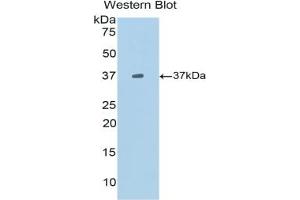 Western blot analysis of the recombinant protein. (CXCL13 antibody  (AA 22-109))