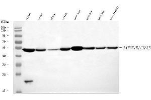 Western blot analysis of ATP5F1B using anti-ATP5F1B antibody (ABIN7599866). (Atp5f1b (AA 123-529) antibody)