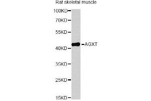 Western blot analysis of extracts of rat skeletal muscle, using AGXT antibody (ABIN6291533) at 1:1000 dilution.