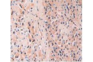 Immunohistochemistry (Paraffin-embedded Sections) (IHC (p)) image for Rabbit anti-Human IgG4 (AA 222-327) antibody (ABIN2862700)