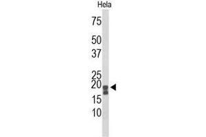 Western blot analysis of ACP1 Antibody (N-term) in Hela cell line lysates (35 µg/lane). (ACP1 antibody  (N-Term))