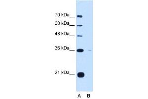 TOR1B antibody used at 5 ug/ml to detect target protein. (TOR1B antibody)