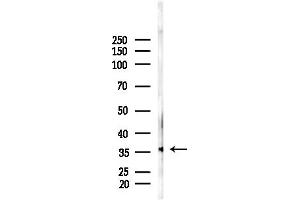 Western blot analysis of lysates from F10-LUC cells(LPS, 4h treatment), using OR52N5 Antibody at 1/1000 dilution.