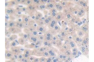 IHC-P analysis of Mouse Liver Tissue, with DAB staining. (Complement Factor B antibody  (AA 474-590))
