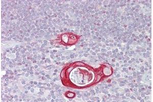 Anti-FAIM / FAIM1 antibody IHC staining of human thymus. (FAIM antibody  (AA 35-84))