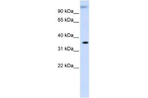 WB Suggested Anti-DHDH Antibody Titration: 0. (DHDH antibody  (Middle Region))