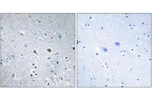 Immunohistochemistry analysis of paraffin-embedded human brain tissue, using Stathmin 1 (Ab-37) Antibody.