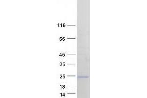 Western Blotting (WB) image for ADP-Ribosylation Factor-Like 5A (ARL5A) (Transcript Variant 3) protein (Myc-DYKDDDDK Tag) (ABIN2714912)